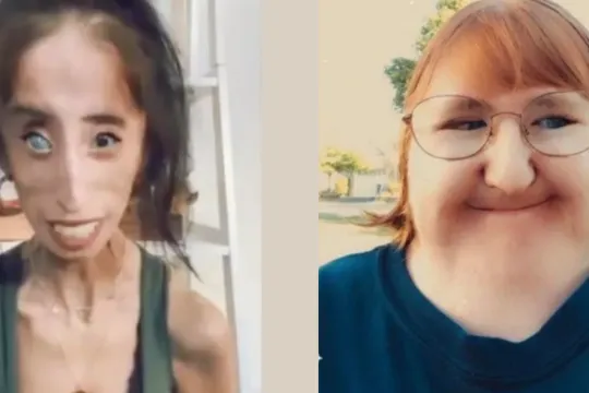 Links Lizzie Velasquez, rechts Melissa Blake