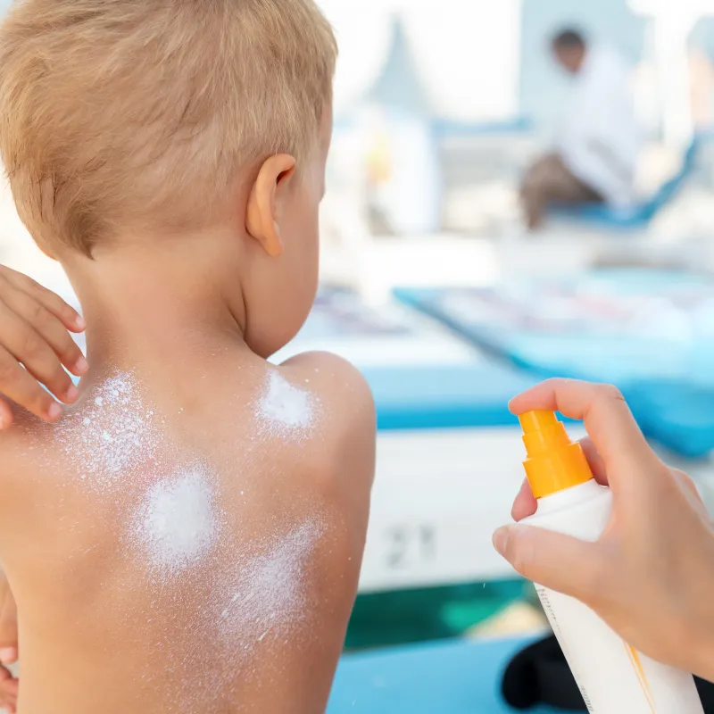 KVW - kinderzonnebrand zonnebrandcrème kinderen