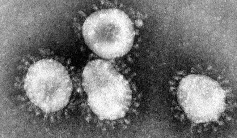 Coronaviruses. Photo credit: Dr. Fred Murphy/Centers for Disease Control and Prevention's Public Health Image Library (PHIL), with identification number #4814. 