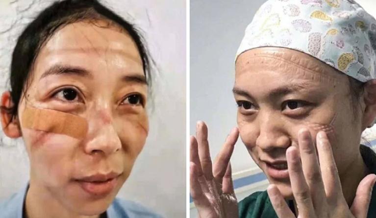 Chinese verpleegsters hebben maskers afgedaan