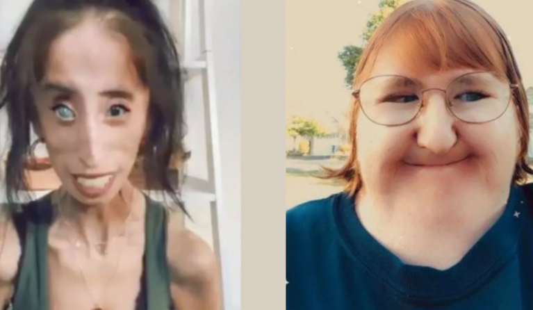 Links Lizzie Velasquez, rechts Melissa Blake