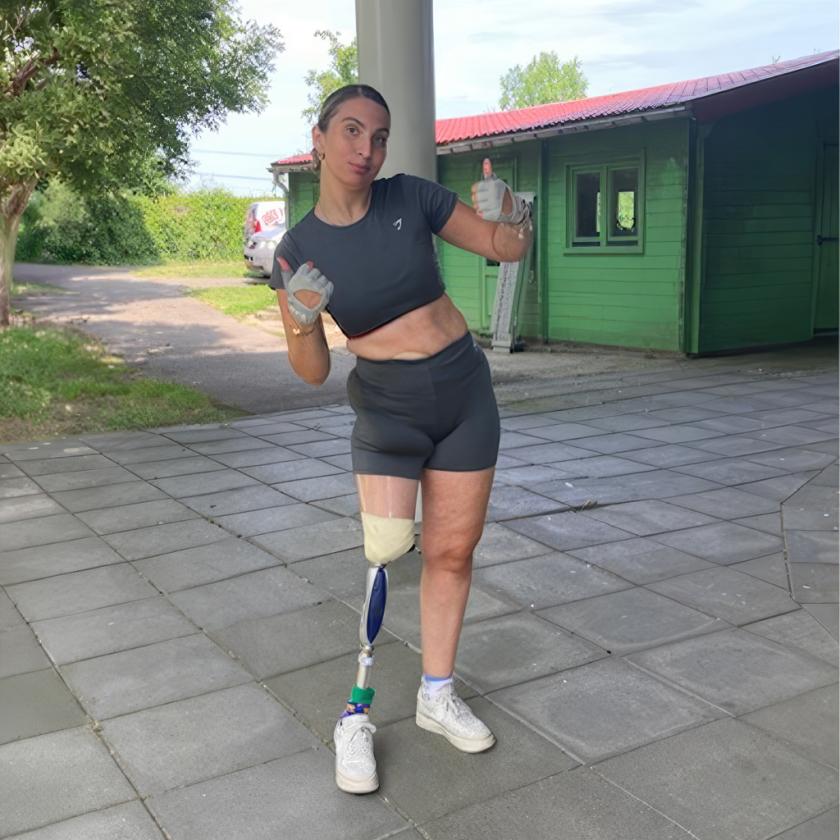 Marjolein Koning met beenprothese 