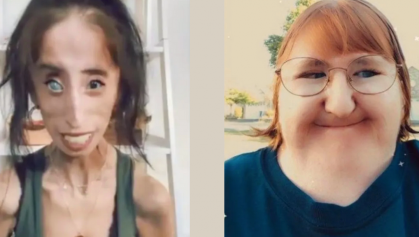 Links Lizzie Velasquez, rechts Melissa Blake Links Lizzie Velasquez, rechts Melissa Blake