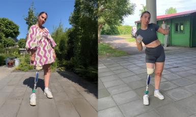 Marjolein met beenprothese in jurkje en sportoutfit