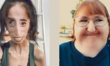 Links Lizzie Velasquez, rechts Melissa Blake